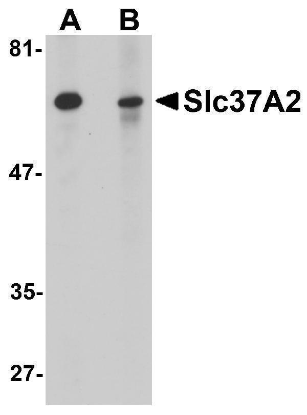 a11124 slc37a2 primary antibodies wb testing 1