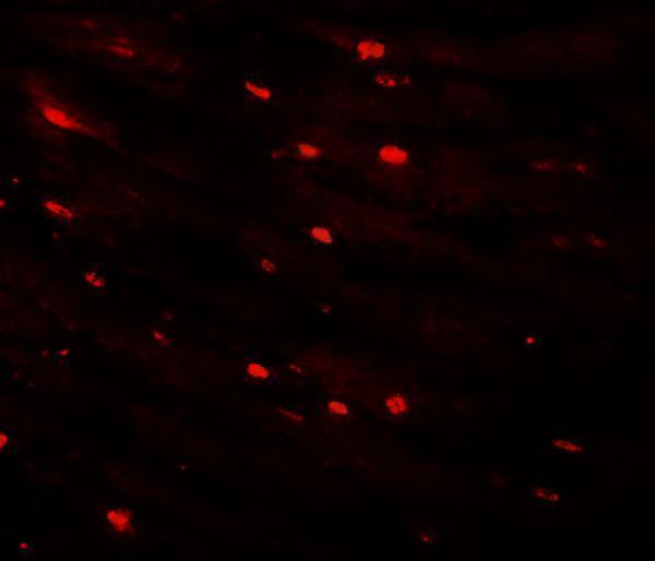 Immunofluorescence of CAZIP in mouse heart tissue with CAZIP antibody at 20 μg/mL