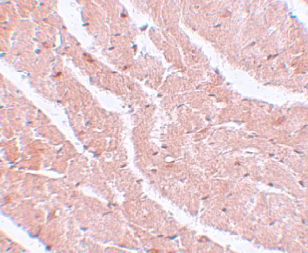 Immunohistochemistry of CAZIP in mouse heart tissue with CAZIP antibody at 5 μg/mL