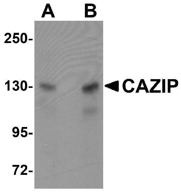 Western blot analysis of CAZIP in A20 cell lysate with CAZIP antibody at (A) 0