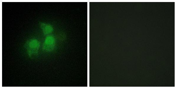 a11126 1 ippk primary antibodies if testing 1