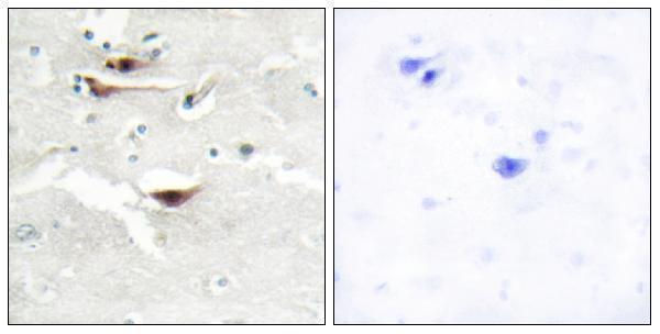 a11126 1 ippk primary antibodies ihc testing 2
