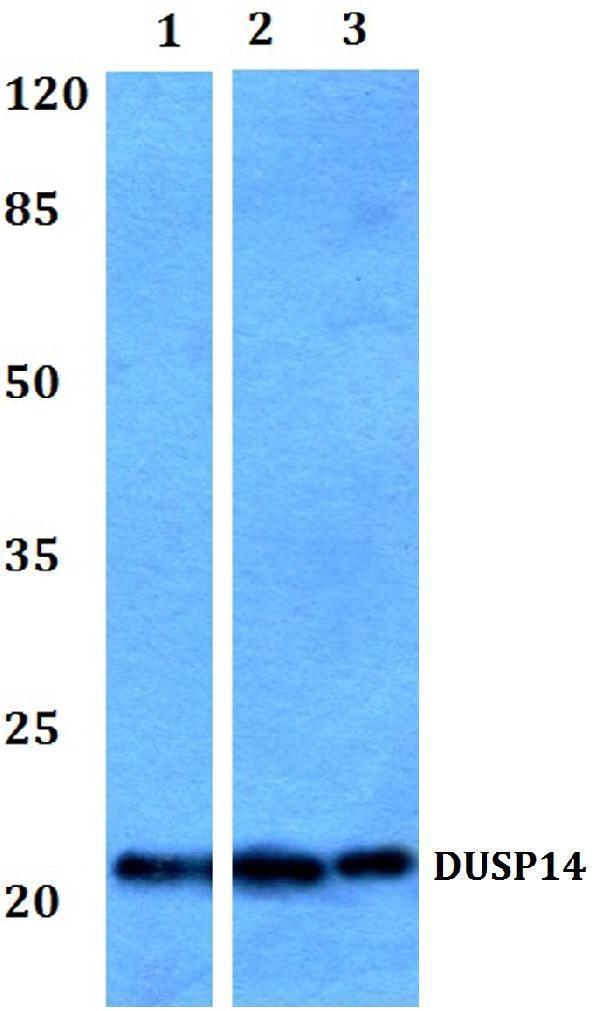 Western blot (WB) analysis of DUSP14 polyclonal antibody at 1:500 dilution
Lane1:Hela whole cell lysate
Lane2:Mouse testis tissue lysate
Lane3:Rat testis tissue lysate