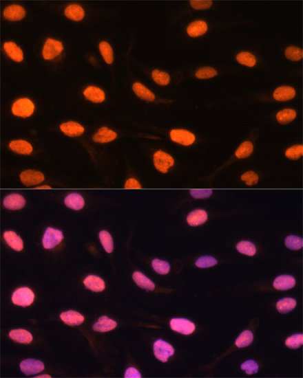 Immunofluorescence analysis of U-2 OS cells using ZBED1 antibody  at dilution of 1:100