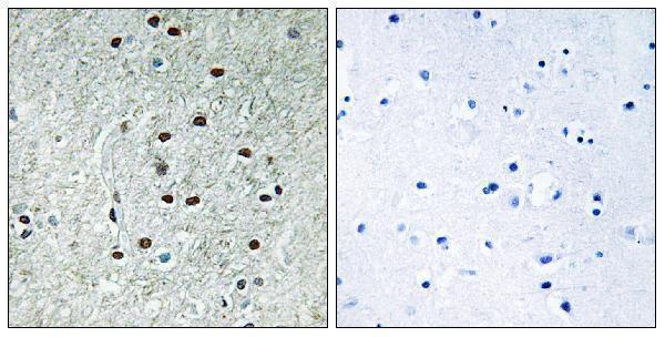 Immunohistochemistry analysis of paraffin-embedded human brain, using REXO1 Antibody