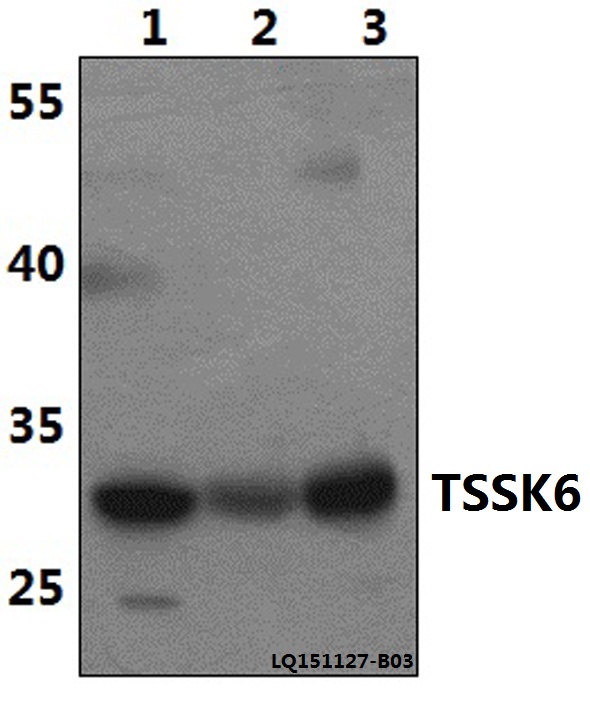 a11136 tssk6 primary antiboties wb testing 1