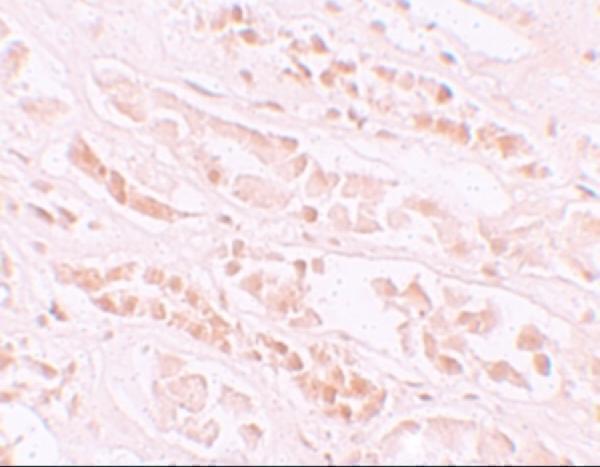 a11139 efcab4b primary antibodies ihc testing 2
