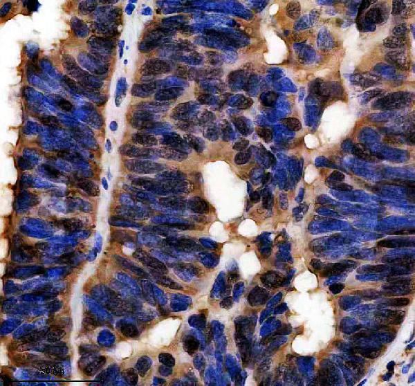 IHC analysis of EXOSC7 using anti-EXOSC7 antibody (A11141-1)