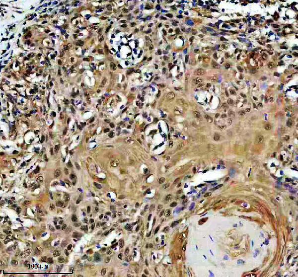 IHC analysis of EXOSC7 using anti-EXOSC7 antibody (A11141-1)