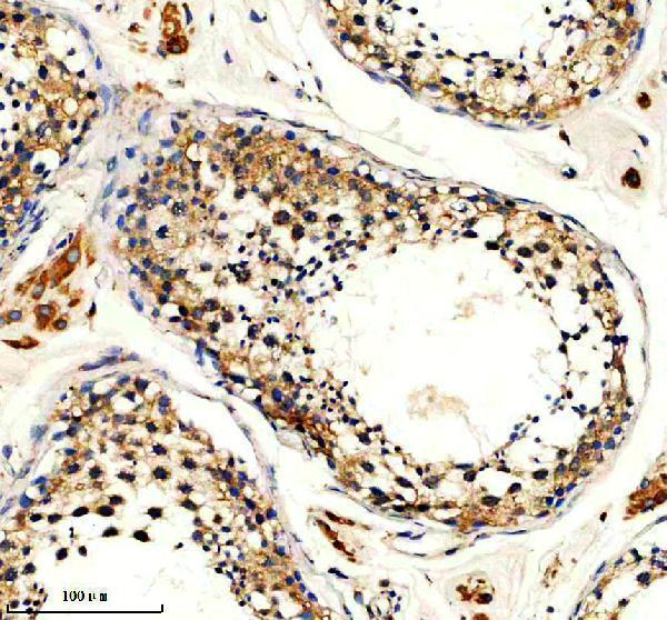 IHC analysis of HINT2 using anti-HINT2 antibody (A11143-1)