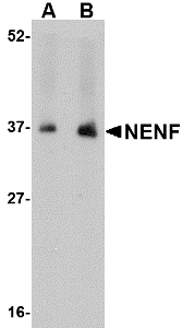 Western blot analysis of NENF in human kidney tissue lysate with NENF antibody at (A) 1 and (B) 2 μg/mL