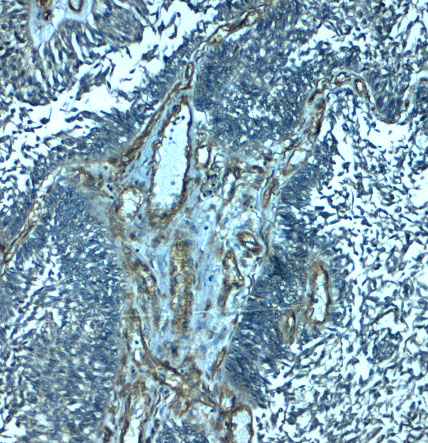 Immunohistochemistry of PALMD in human bladder tissue with PALMD antibody at 2