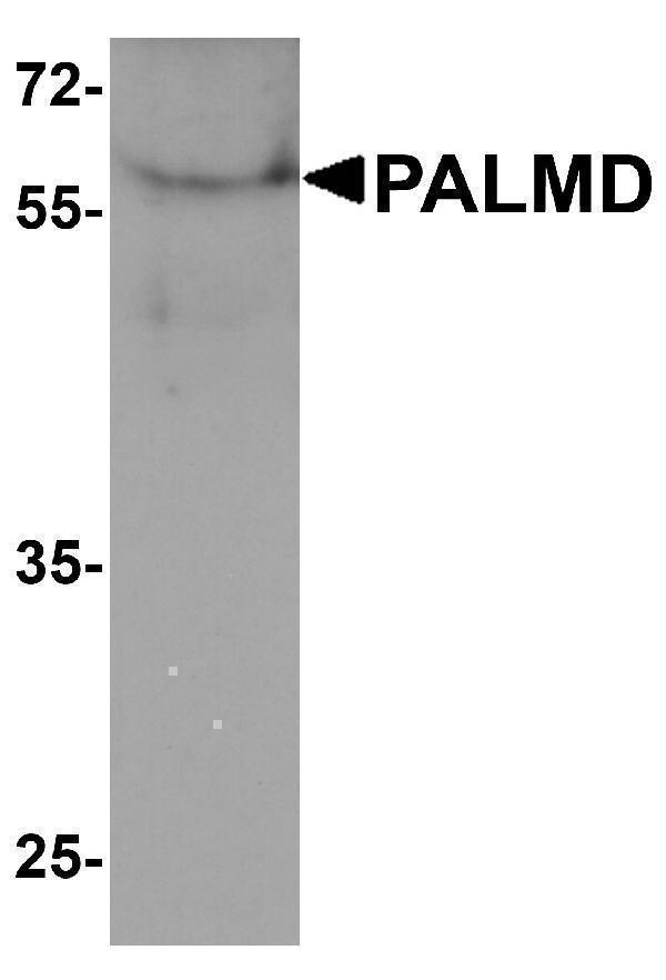Western blot analysis of PALMD in human bladder tissue lysate with PALMD antibody at 1 μg/ml