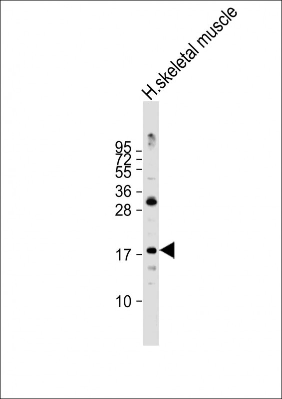 Anti-ND4L Antibody (C-term) at 1:2000 dilution + human skeletal muscle lysateLysates/proteins at 20 µg per lane