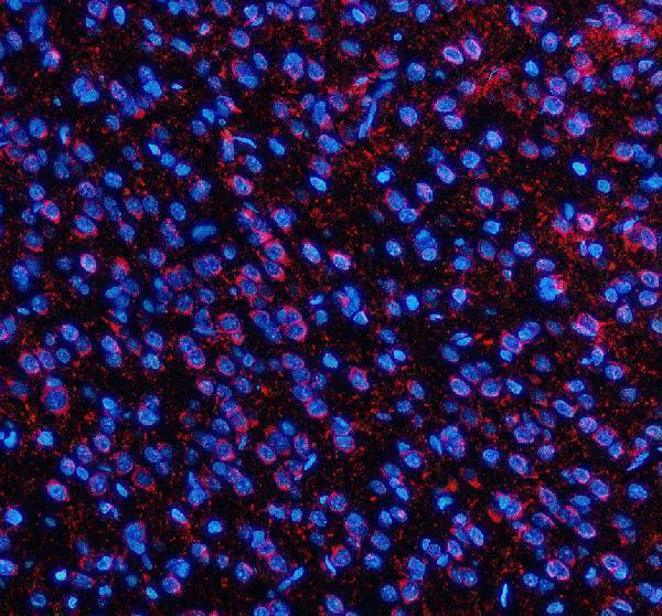 a11162 2 slc7a14 primary antibodies if testing 2