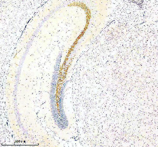 IHC analysis of SLC7A14 using anti-SLC7A14 antibody (A11162-2)