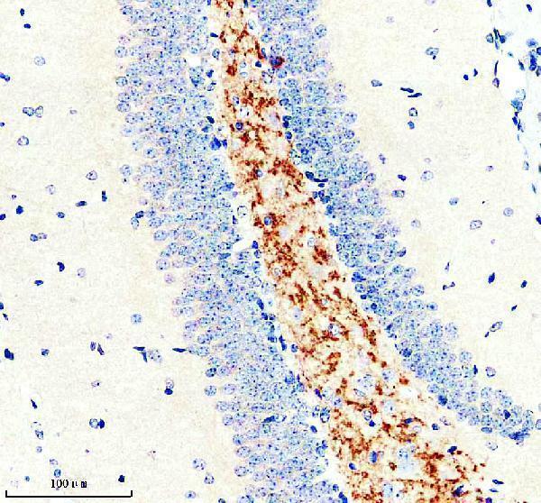 IHC analysis of SLC7A14 using anti-SLC7A14 antibody (A11162-2)