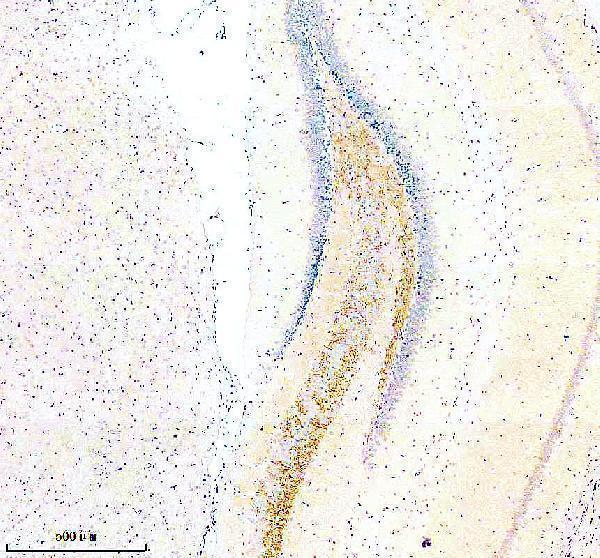 a11162 2 slc7a14 primary antibodies ihc testing 3