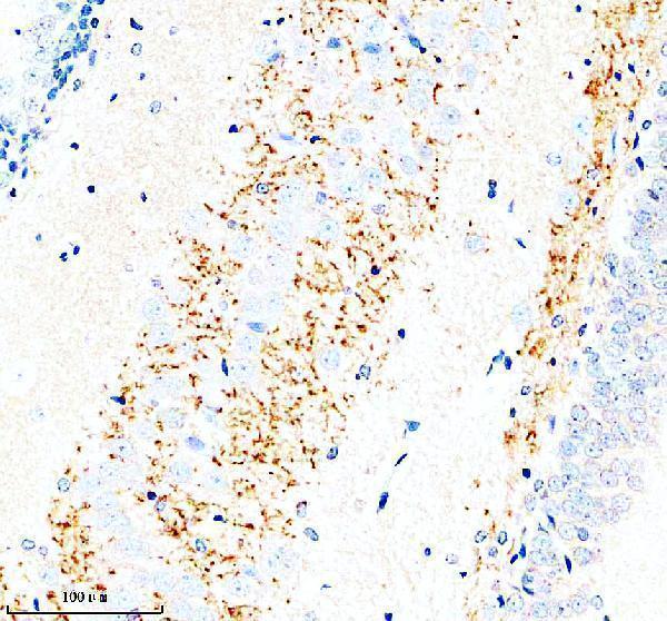a11162 2 slc7a14 primary antibodies ihc testing 4