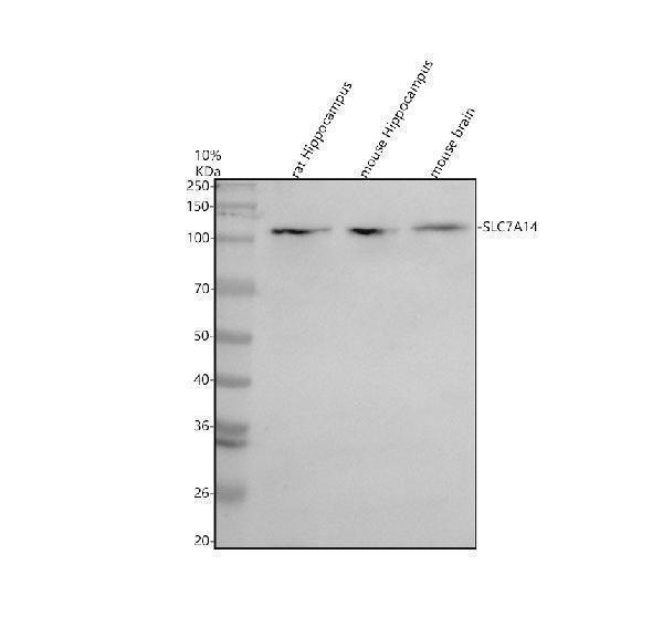 Western blot analysis of SLC7A14 using anti-SLC7A14 antibody (A11162-2)