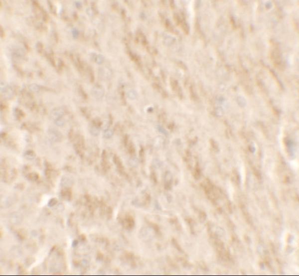 a11164 tlx2 primary antibodies ihc testing 2
