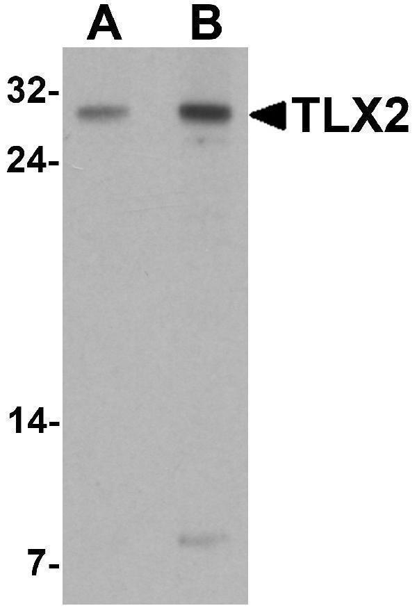 a11164 tlx2 primary antibodies wb testing 1
