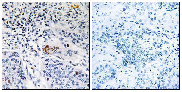 a11168 1 zbtb40 primary antibodies ihc testing 1