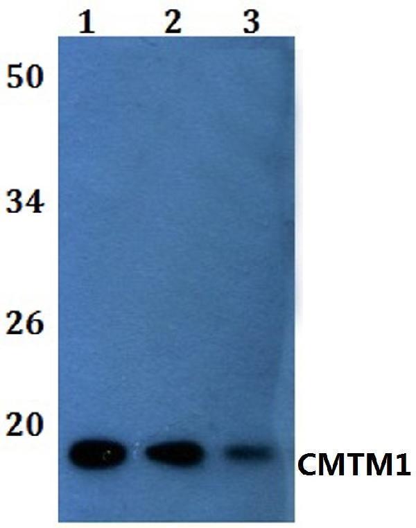 a11171 1 cmtm1 primary antiboties wb testing 1
