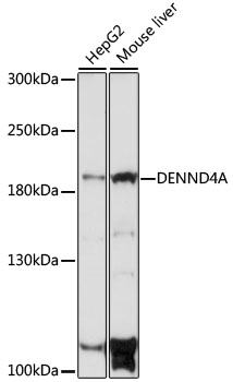 Western blot analysis of extracts of various cell lines, using DENND4A antibody  at 1:1000 dilution