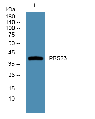 a11174 prss23 primary antibodies wb testing 1