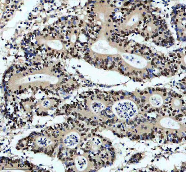 a11176 1 dach2 primary antibodies ihc testing 1