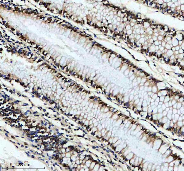 a11176 1 dach2 primary antibodies ihc testing 2