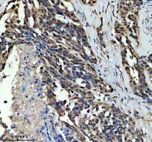 a11176 1 dach2 primary antibodies ihc testing 3