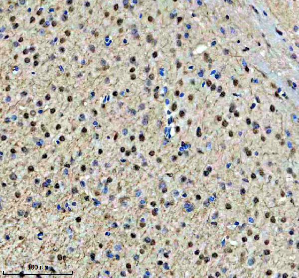 a11176 1 dach2 primary antibodies ihc testing 4