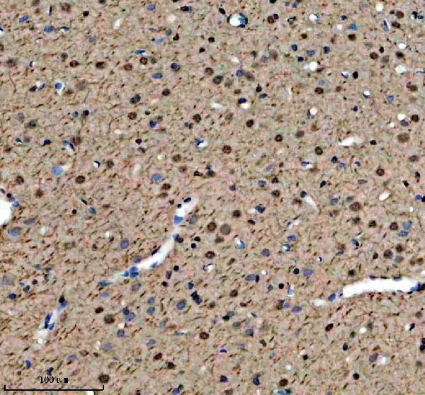a11176 1 dach2 primary antibodies ihc testing 5