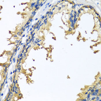 Immunohistochemistry of paraffin-embedded human prostate using NLGN4Y antibody at dilution of 1:100 (x40 lens)