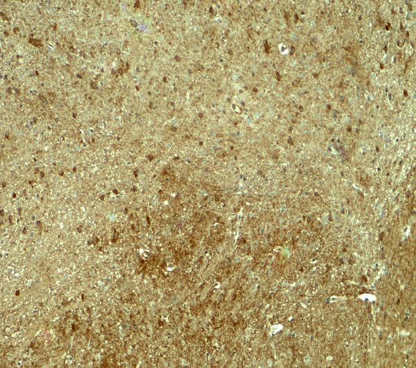 a11179 pja1 primary antibodies ihc testing 2