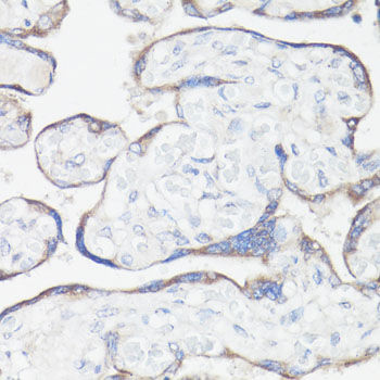 a11184 cluh primary antiboties ihc testing 2
