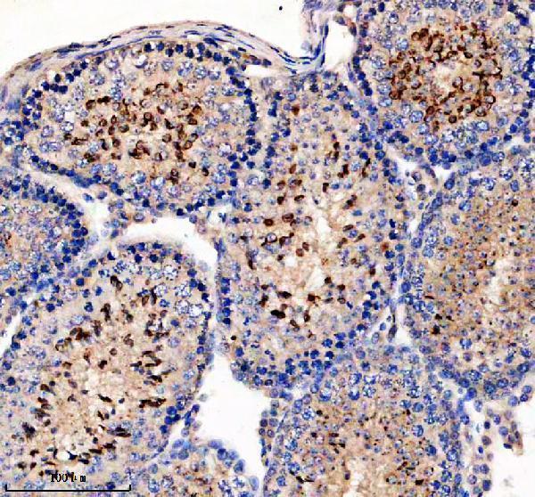 a11185 1 gpx6 primary antibodies ihc testing 1