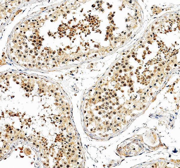 a11185 1 gpx6 primary antibodies ihc testing 2