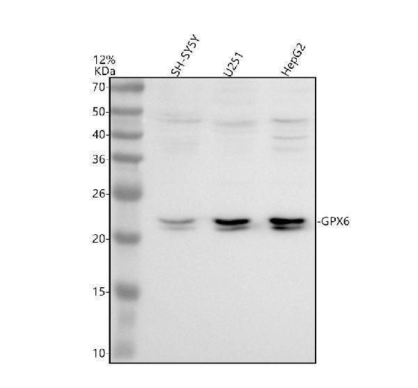 a11185 1 gpx6 primary antibodies wb testing 1