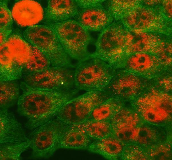 IF analysis of KIAA0182/GSE1 using anti-KIAA0182/GSE1 antibody (A11186-1) and anti-Alpha Tubulin antibody (M03989-3)