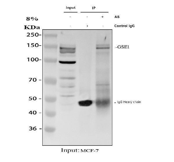Immunoprecipitating KIAA0182/GSE1 in MCF-7 whole cell lysate