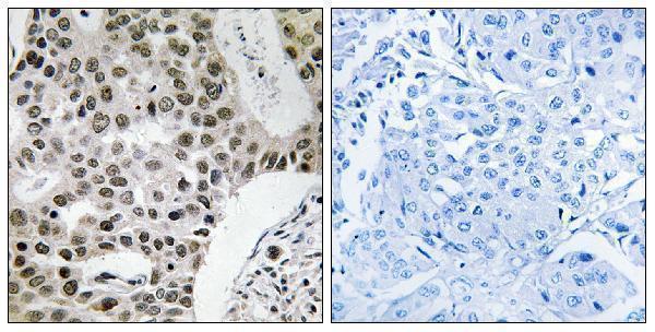 a11190 zmym4 primary antibodies ihc testing 1