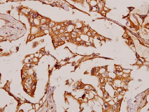 a11194 1 noc2l primary antiboties ihc testing 2