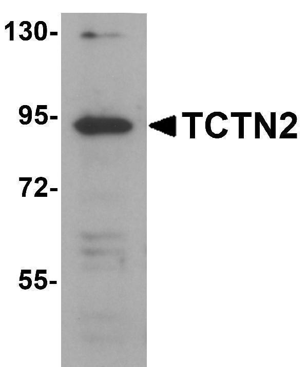 a11196 tctn2 primary antibodies wb testing 1
