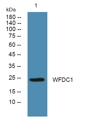 Western blot analysis of lysates from A431 cells, primary antibody was diluted at 1:1000, 4°over night
