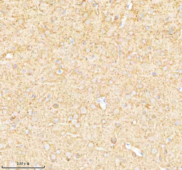Figure 3. IHC analysis of Synaptoporin/SYNPR using anti-Synaptoporin/SYNPR antibody (A11201-2). Synaptoporin/SYNPR was detected in a paraffin-embedded section of rat brain tissue. Heat mediated antigen retrieval was performed in EDTA buffer (pH 8.0, epitope retrieval solution). The tissue section was blocked with 10% goat serum. The tissue section was then incubated with 2 microg/ml rabbit anti-Synaptoporin/SYNPR Antibody (A11201-2) overnight at 4°C. Peroxidase Conjugated Goat Anti-rabbit IgG was used as secondary antibody and incubated for 30 minutes at 37°C. The tissue section was developed using HRP Conjugated Rabbit IgG Super Vision Assay Kit (Catalog # SV0002) with DAB as the chromogen.
