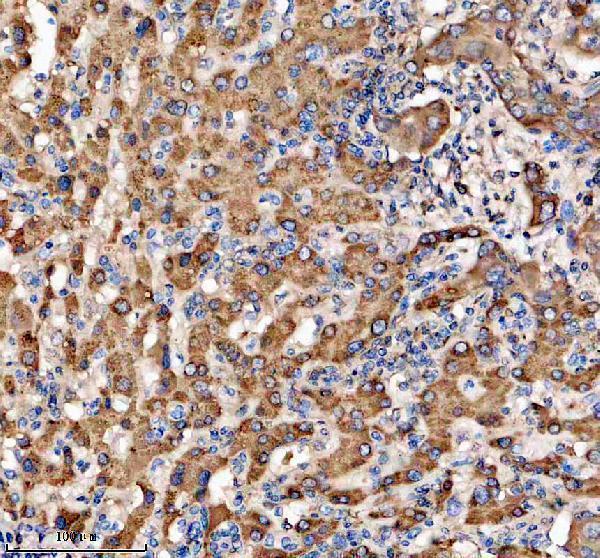 IHC analysis of LGTN using anti-LGTN antibody (A11205-1)