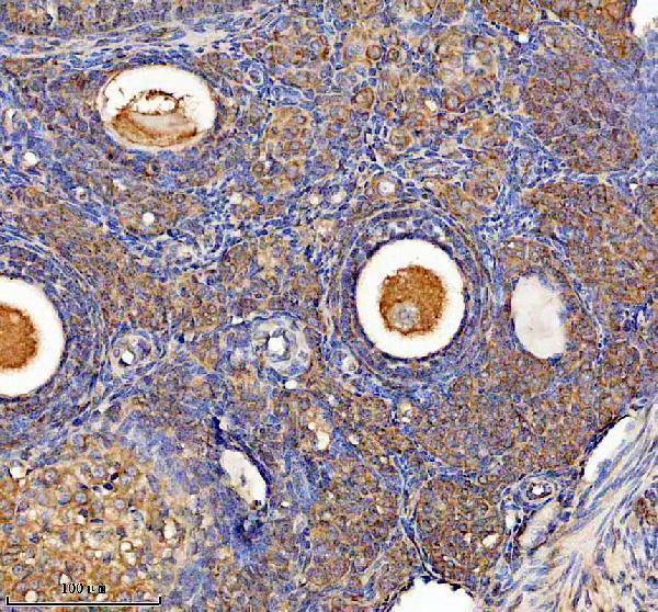 IHC analysis of LGTN using anti-LGTN antibody (A11205-1)